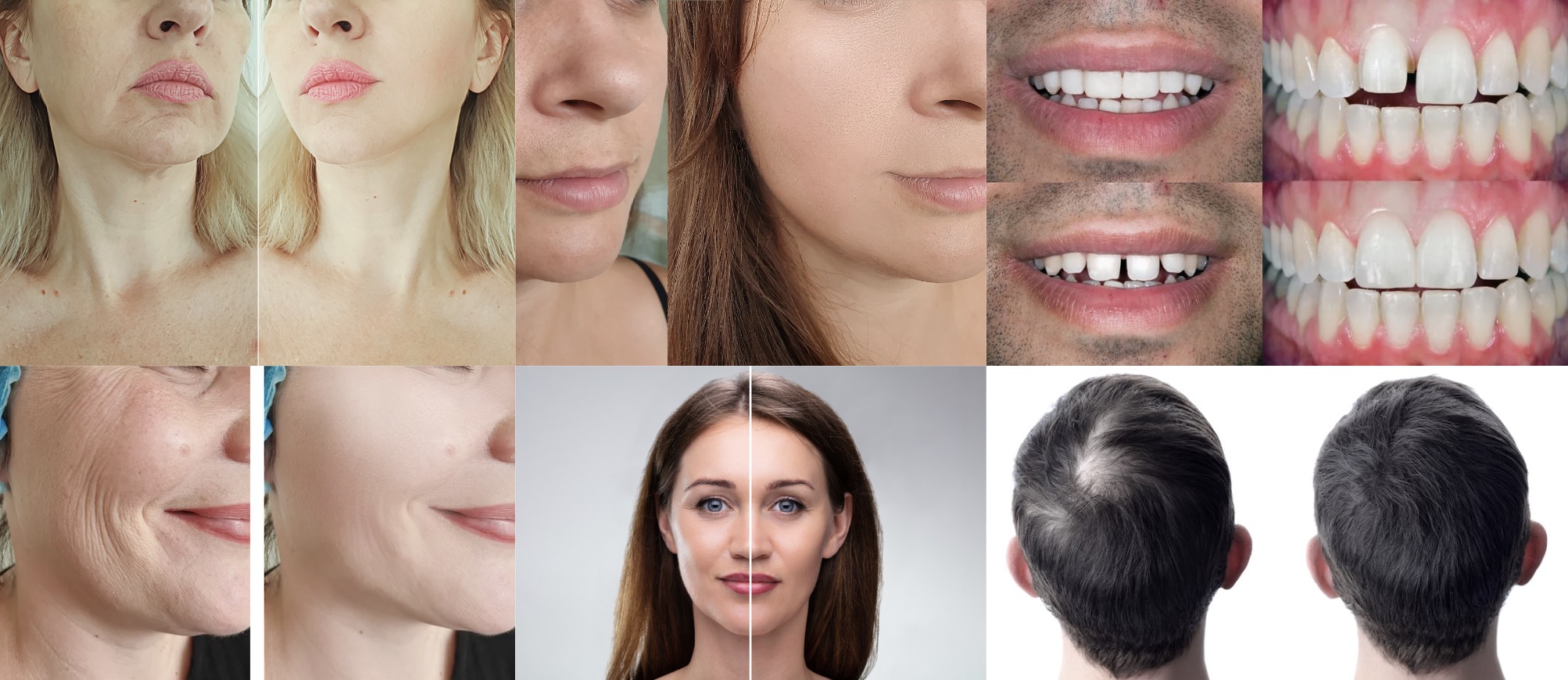 Öncesi Sonrası Görseller Yasak mı